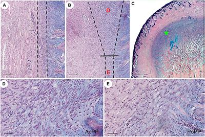 Calreticulin Identified as One of the Androgen Response Genes That Trigger Full Regeneration of the Only Capable Mammalian Organ, the Deer Antler